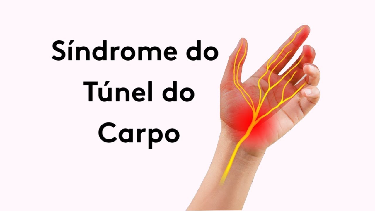 Síndrome do Túnel do Carpo